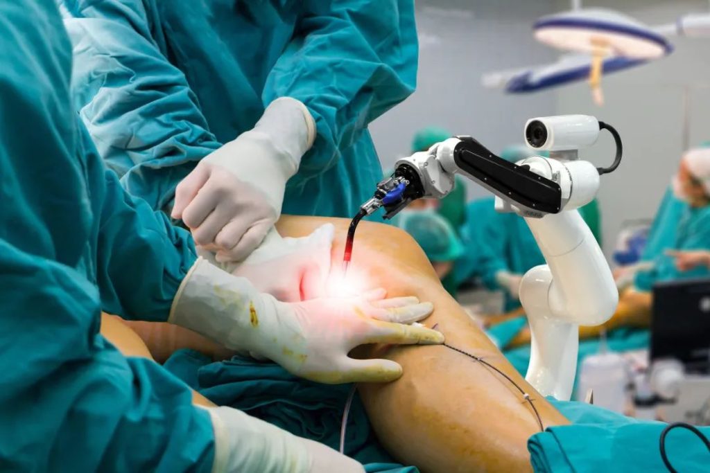 Robotic Knee replacement in Madurai